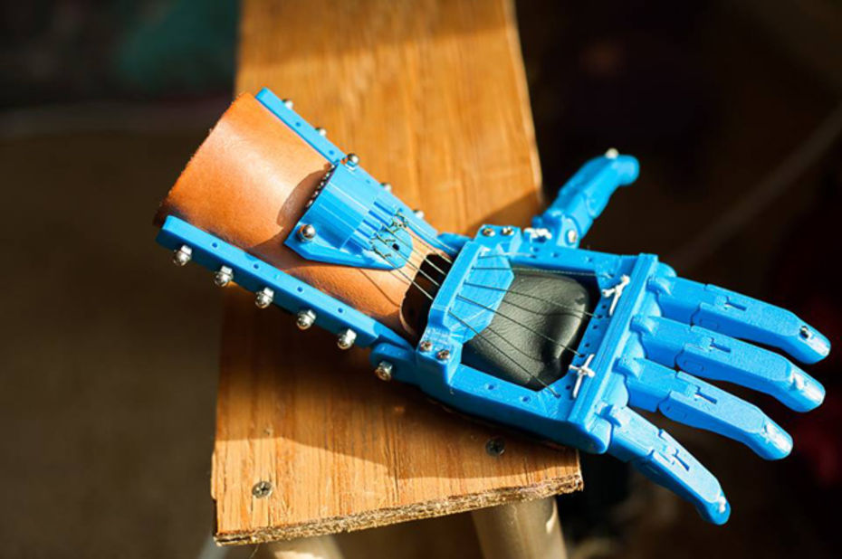 main prothèse imprimée en 3D